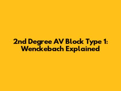 2nd Degree AV Block Type 1: Wenckebach Explained